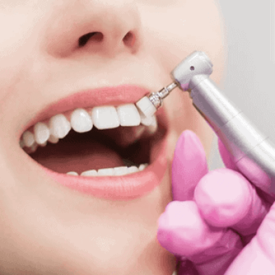 Odonto Segura Sorocaba Clinica Odontologica Serviços em Implantes em Sorocaba (4) Odonto Segura Sorocaba Clinica Odontologica Serviços em Implantes em Sorocaba (4)